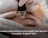 Microdermabrasion in Invercargill: Real Results for Smoother, Brighter Skin