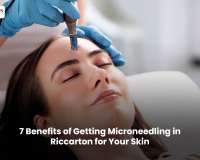 7 Benefits of Getting Microneedling in Riccarton for Your Skin