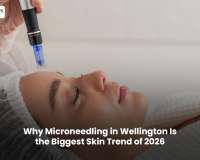 Why Microneedling in Wellington Is the Biggest Skin Trend of 2026
