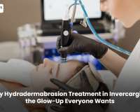 Why Hydradermabrasion Treatment in Invercargill Is the Glow-Up Everyone Wants