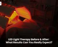 LED Light Therapy Before & After: What Results Can You Really Expect?