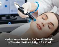 Hydradermabrasion for Sensitive Skin: Is This Gentle Facial Right for You?