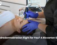 Is Hydradermabrasion Right for You? A Riccarton Guide