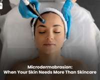 Microdermabrasion: When Your Skin Needs More Than Skincare