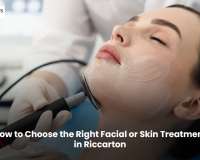 How to Choose the Right Facial or Skin Treatment in Riccarton